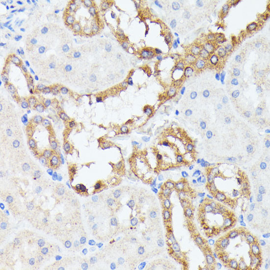 PTP4A2 Antibody in Immunohistochemistry (Paraffin) (IHC (P))