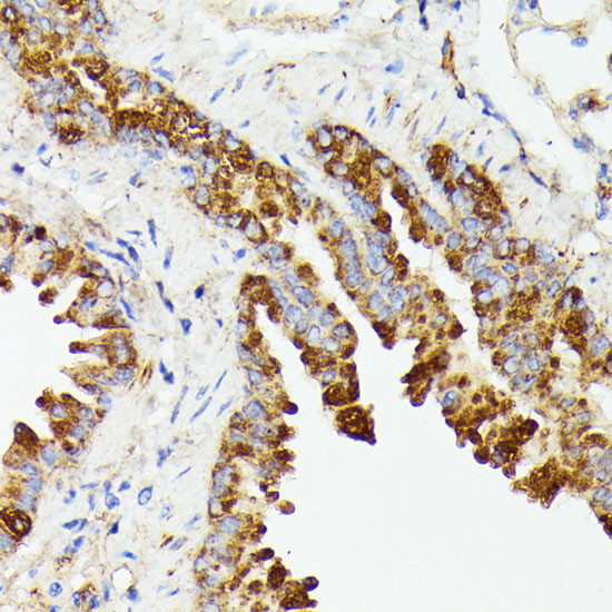 PTP4A2 Antibody in Immunohistochemistry (Paraffin) (IHC (P))