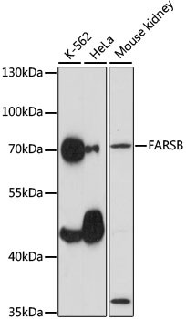 FARSB Antibody in Western Blot (WB)