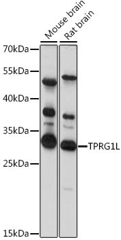 TPRG1L Antibody in Western Blot (WB)