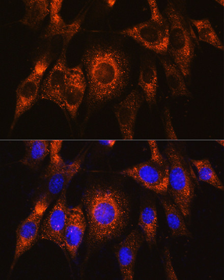 UBAC2 Antibody in Immunocytochemistry (ICC/IF)