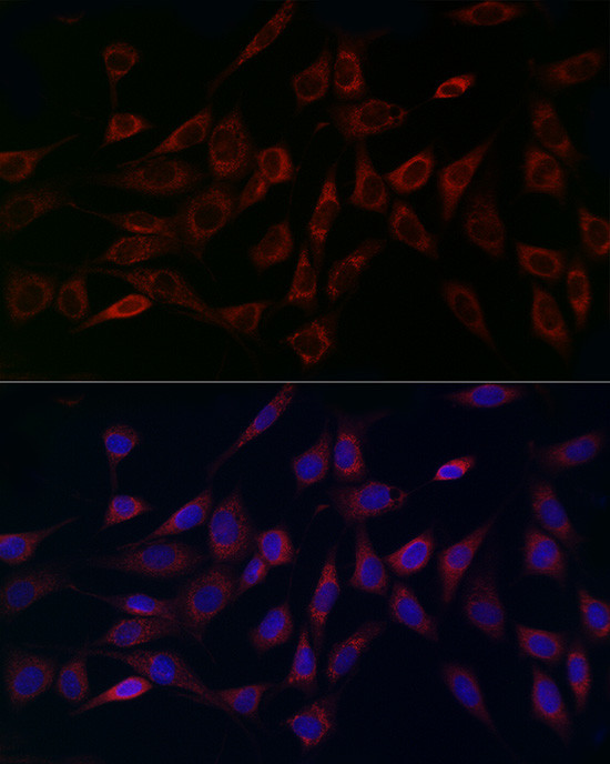 MCU Antibody in Immunocytochemistry (ICC/IF)