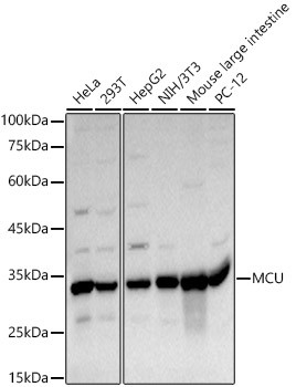 MCU Antibody in Western Blot (WB)