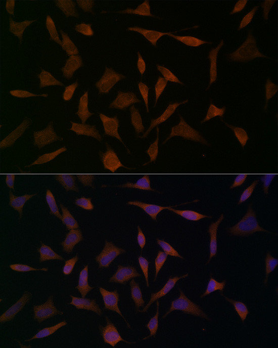 BCAT1 Antibody in Immunocytochemistry (ICC/IF)