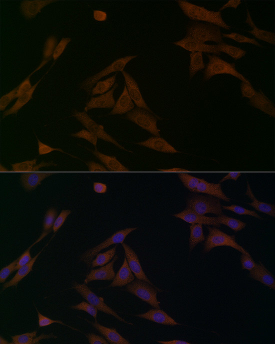 BCAT1 Antibody in Immunocytochemistry (ICC/IF)