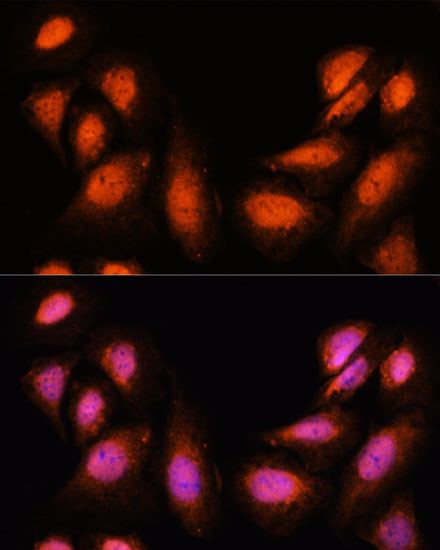 SPT6 Antibody in Immunocytochemistry (ICC/IF)