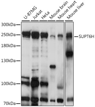 SPT6 Antibody in Western Blot (WB)