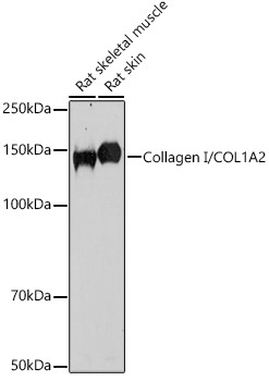 COL1A2 Antibody in Western Blot (WB)