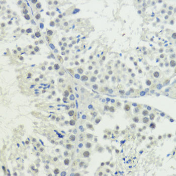 BAZ2A Antibody in Immunohistochemistry (Paraffin) (IHC (P))