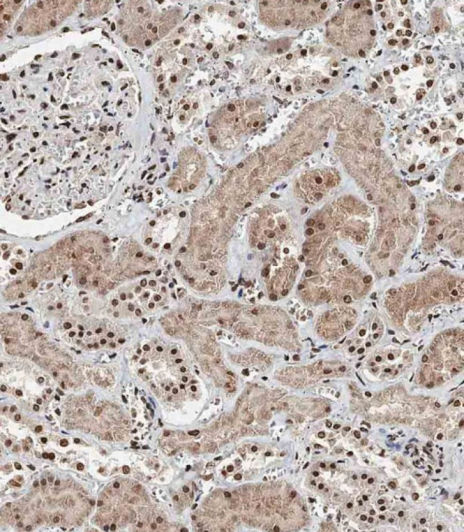 BAP1 Antibody in Immunohistochemistry (Paraffin) (IHC (P))