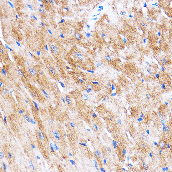 HSPB7 Antibody in Immunohistochemistry (Paraffin) (IHC (P))