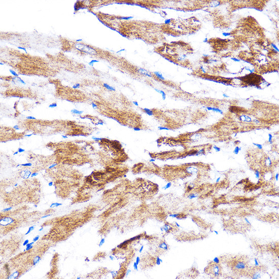 HSPB7 Antibody in Immunohistochemistry (Paraffin) (IHC (P))