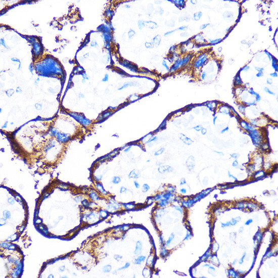 HSPB7 Antibody in Immunohistochemistry (Paraffin) (IHC (P))