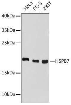 HSPB7 Antibody in Western Blot (WB)