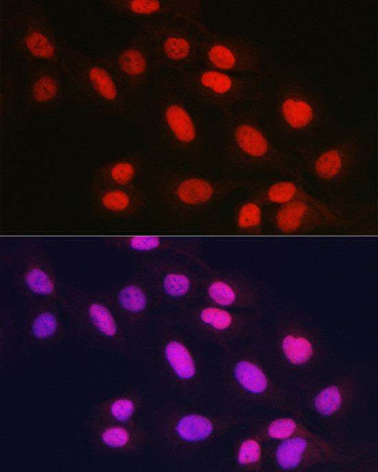 RAD21 Antibody in Immunocytochemistry (ICC/IF)