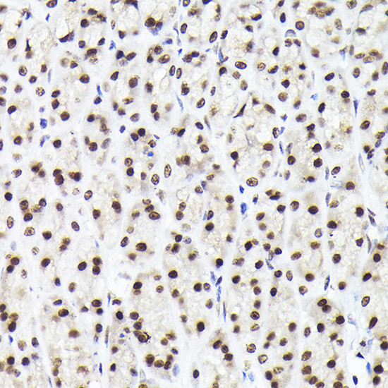 RAD21 Antibody in Immunohistochemistry (Paraffin) (IHC (P))