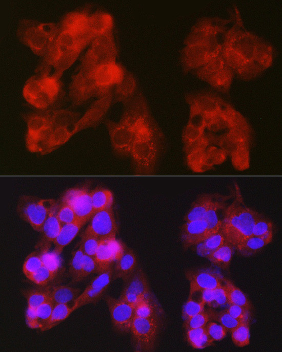 MB67 Antibody in Immunocytochemistry (ICC/IF)