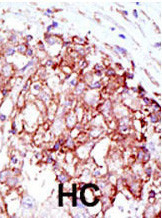 MIB1 Antibody in Immunohistochemistry (Paraffin) (IHC (P))