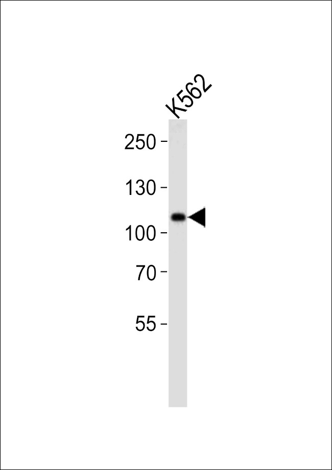 MIB1 Antibody in Western Blot (WB)