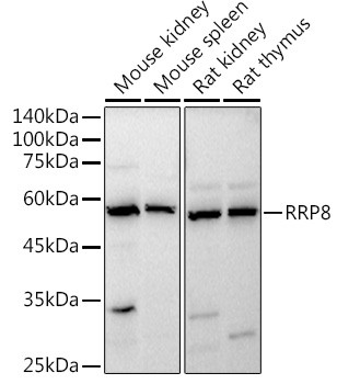 Cerebral Protein 1 Antibody in Western Blot (WB)