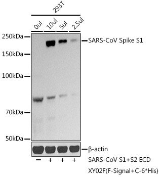 SARS-CoV Spike Protein S1 Antibody in Western Blot (WB)