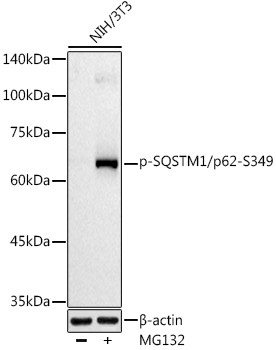 Phospho-SQSTM1 (Ser349) Antibody in Western Blot (WB)