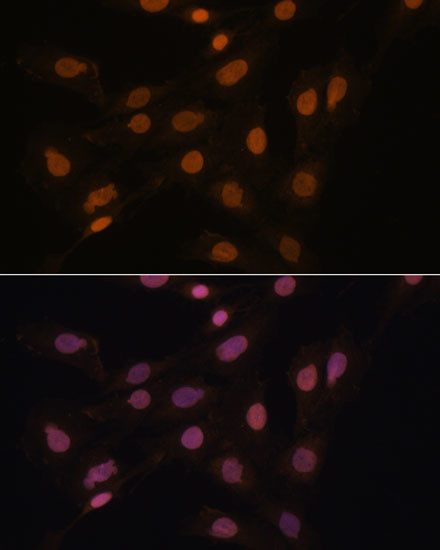 HP1 gamma Antibody in Immunocytochemistry (ICC/IF)