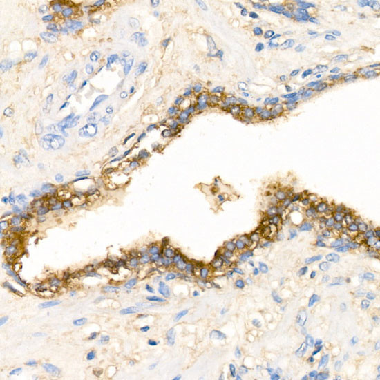 SERPINA3 Antibody in Immunohistochemistry (Paraffin) (IHC (P))