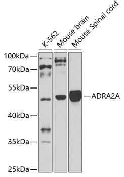 alpha-2a Adrenergic Receptor Antibody in Western Blot (WB)