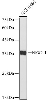 Nkx2.1 Antibody in Western Blot (WB)