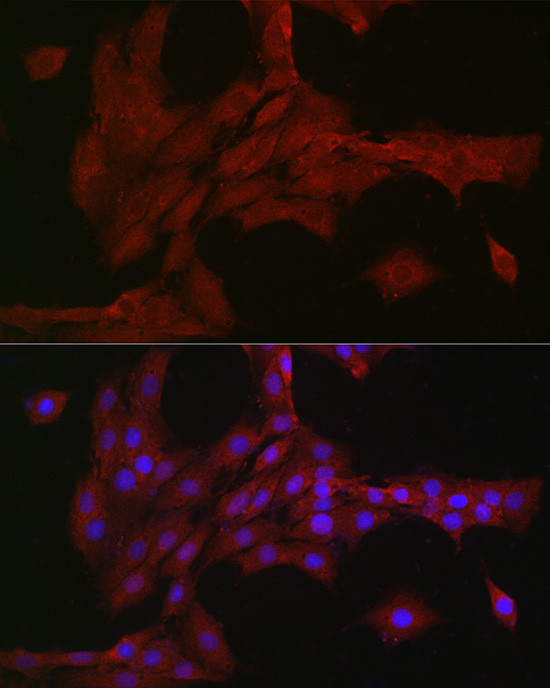 NOTCH3 Antibody in Immunocytochemistry (ICC/IF)