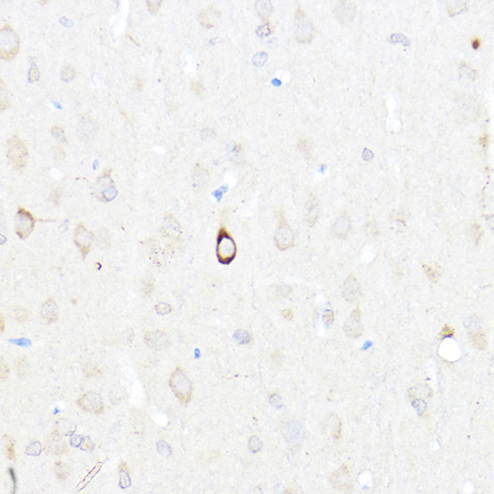 NPY Antibody in Immunohistochemistry (Paraffin) (IHC (P))