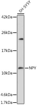 NPY Antibody in Western Blot (WB)