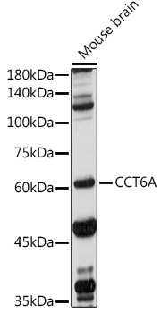 TCP-1 zeta Antibody in Western Blot (WB)