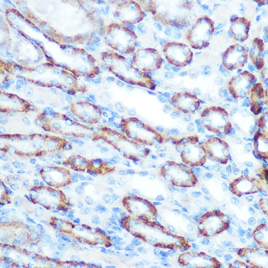 LONP1 Antibody in Immunohistochemistry (Paraffin) (IHC (P))