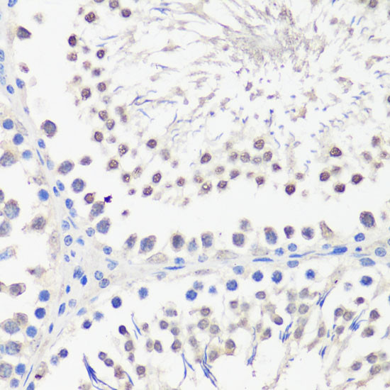 PBK Antibody in Immunohistochemistry (Paraffin) (IHC (P))