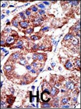 SQSTM1 Antibody in Immunohistochemistry (Paraffin) (IHC (P))