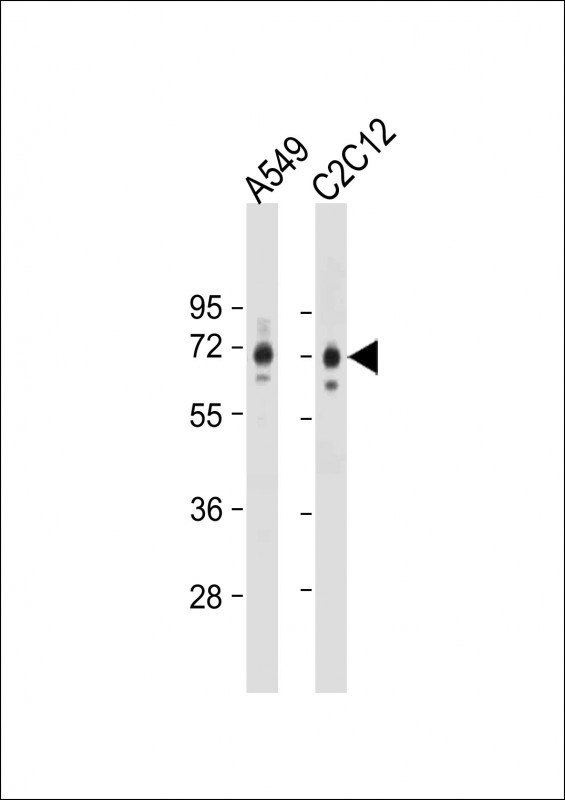 SQSTM1 Antibody in Western Blot (WB)