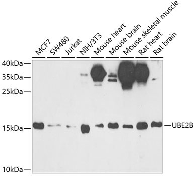 UBE2B Antibody in Western Blot (WB)
