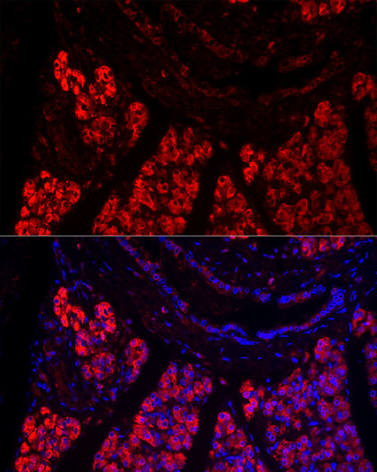 PNLIP Antibody in Immunocytochemistry (ICC/IF)