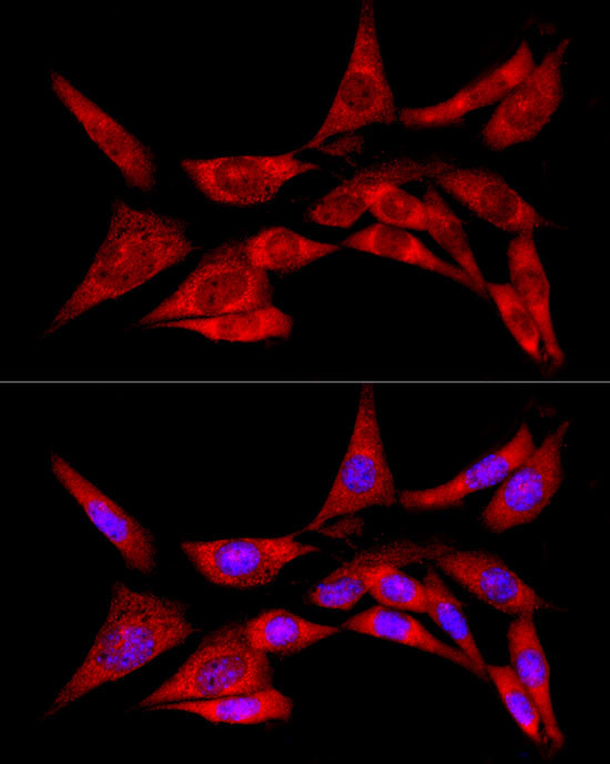 LZIP Antibody in Immunocytochemistry (ICC/IF)