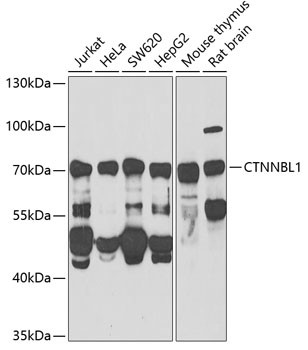 CTNNBL1 Antibody in Western Blot (WB)