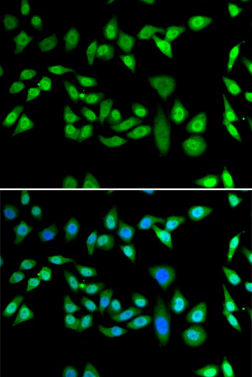 DNAJB6 Antibody in Immunocytochemistry (ICC/IF)