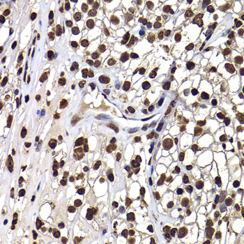 DNAJB6 Antibody in Immunohistochemistry (Paraffin) (IHC (P))