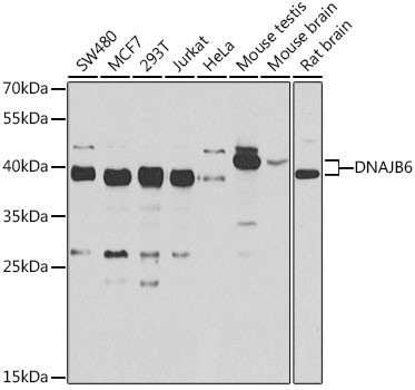 DNAJB6 Antibody in Western Blot (WB)