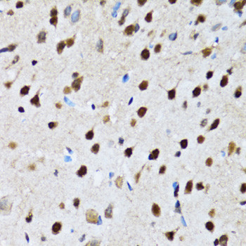 DBC1 Antibody in Immunohistochemistry (Paraffin) (IHC (P))