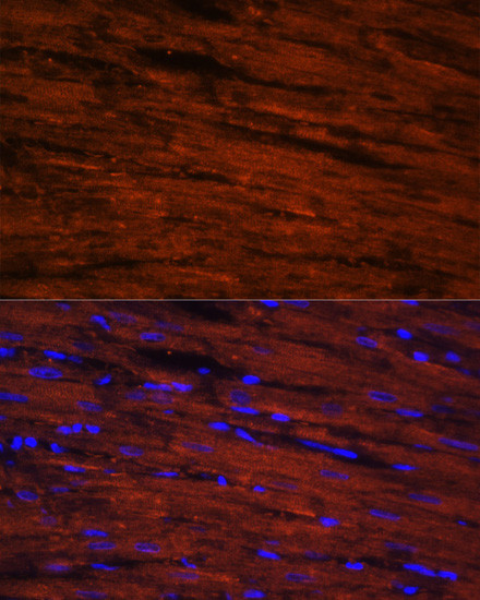 LDB3 Antibody in Immunocytochemistry (ICC/IF)