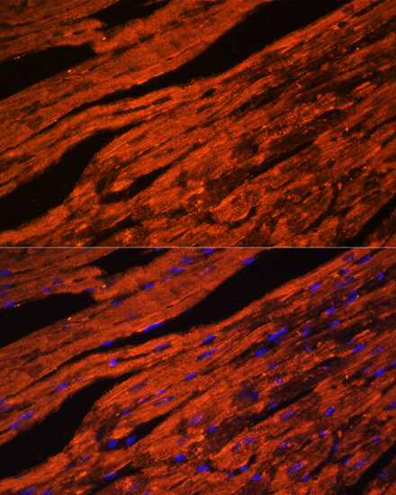 LDB3 Antibody in Immunocytochemistry (ICC/IF)