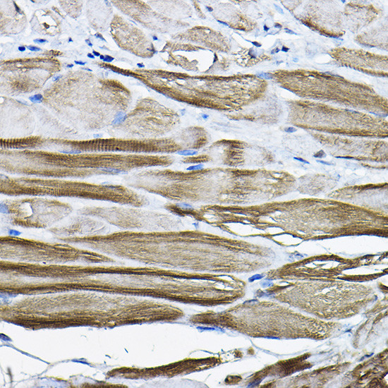 LDB3 Antibody in Immunohistochemistry (Paraffin) (IHC (P))