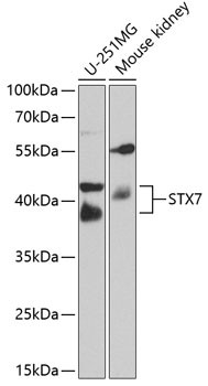 STX7 Antibody in Western Blot (WB)